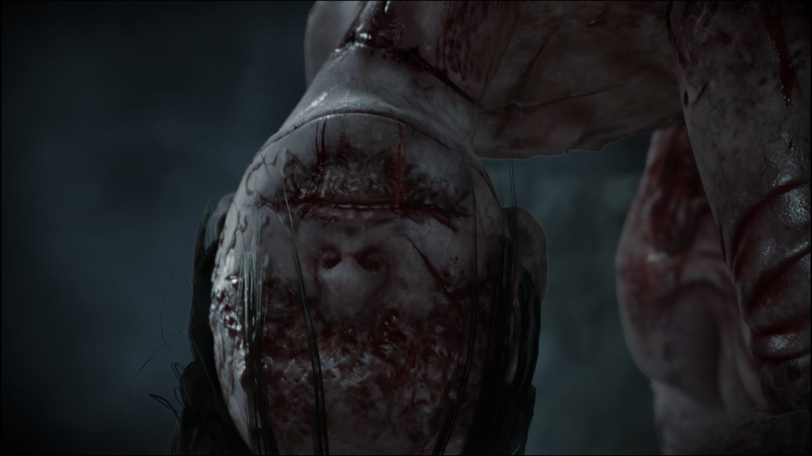 Silent Hill ƒ